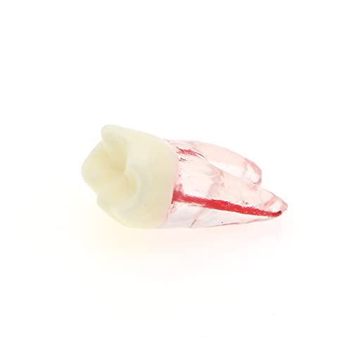 5 יחידות שורש שיניים שורש שיניים עיסת חלל שיניים דגם אנדודונטי תרגול RCT Topodont M8007 11 14 16