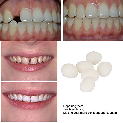 2 יחידות 50 גרם שווא שיניים מוצק דבק, זמני שיניים החלפת ערכת, זמני שן תיקון פערים מילוי שנן דבק שיניים
